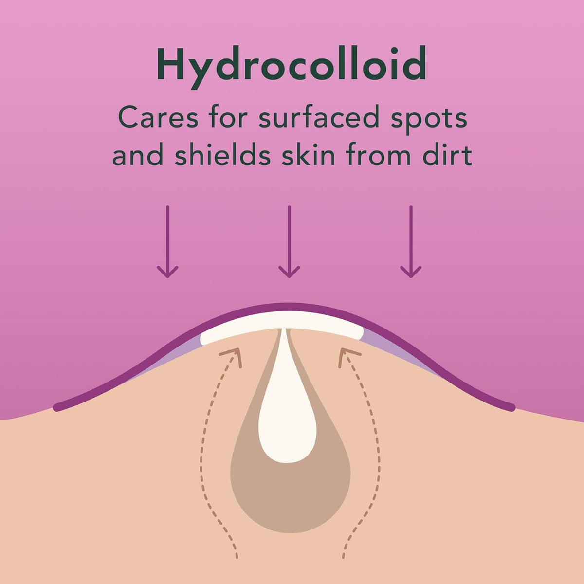 Rael Pimple Patches - Miracle Overnight Spot Cover, Thicker & Extra Adhesion, Hydrocolloid Acne