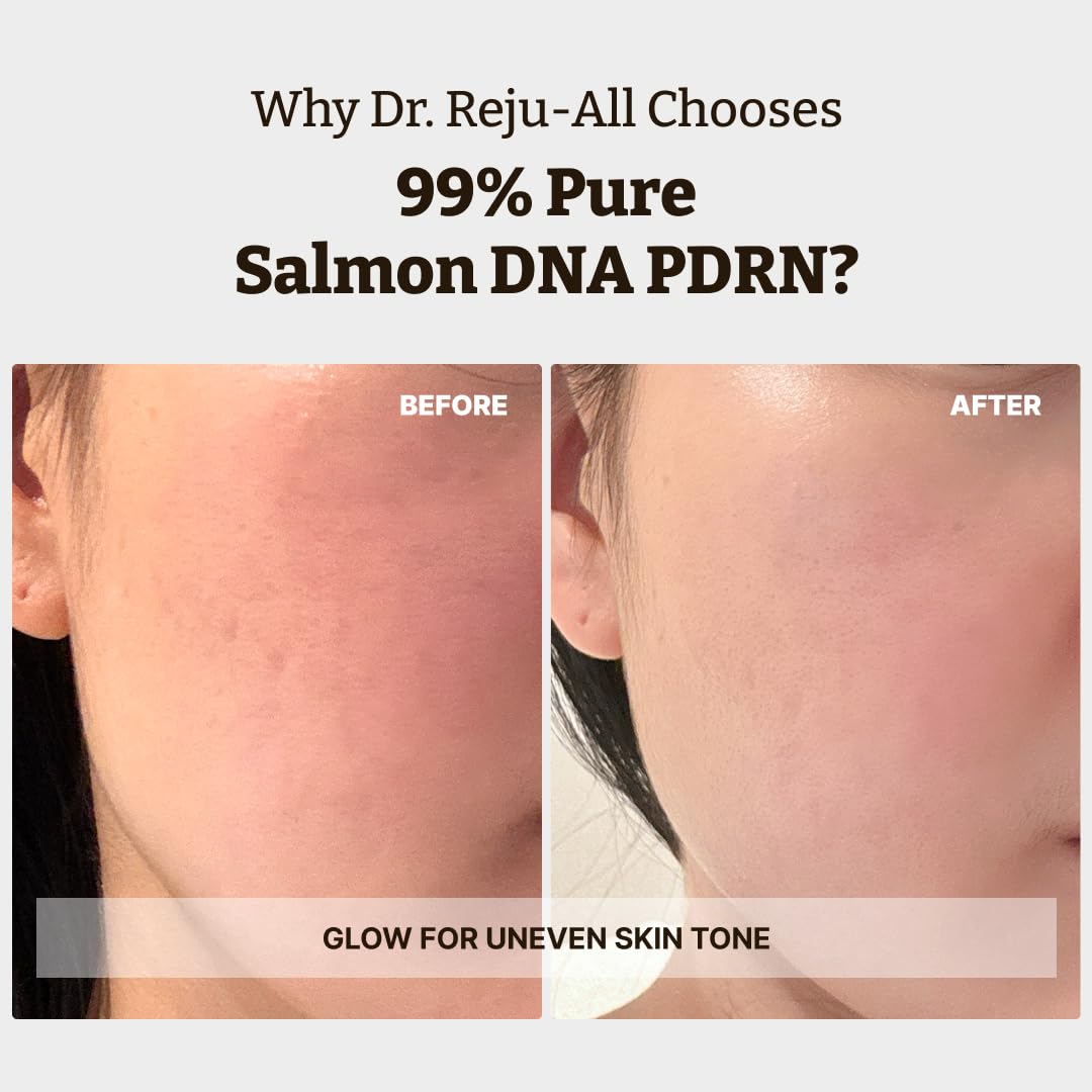 Dr. Reju-All Advanced PDRN Rejuvenating Cream – 99% Pure Salmon DNA PDRN Face Moisturizer – Optimal