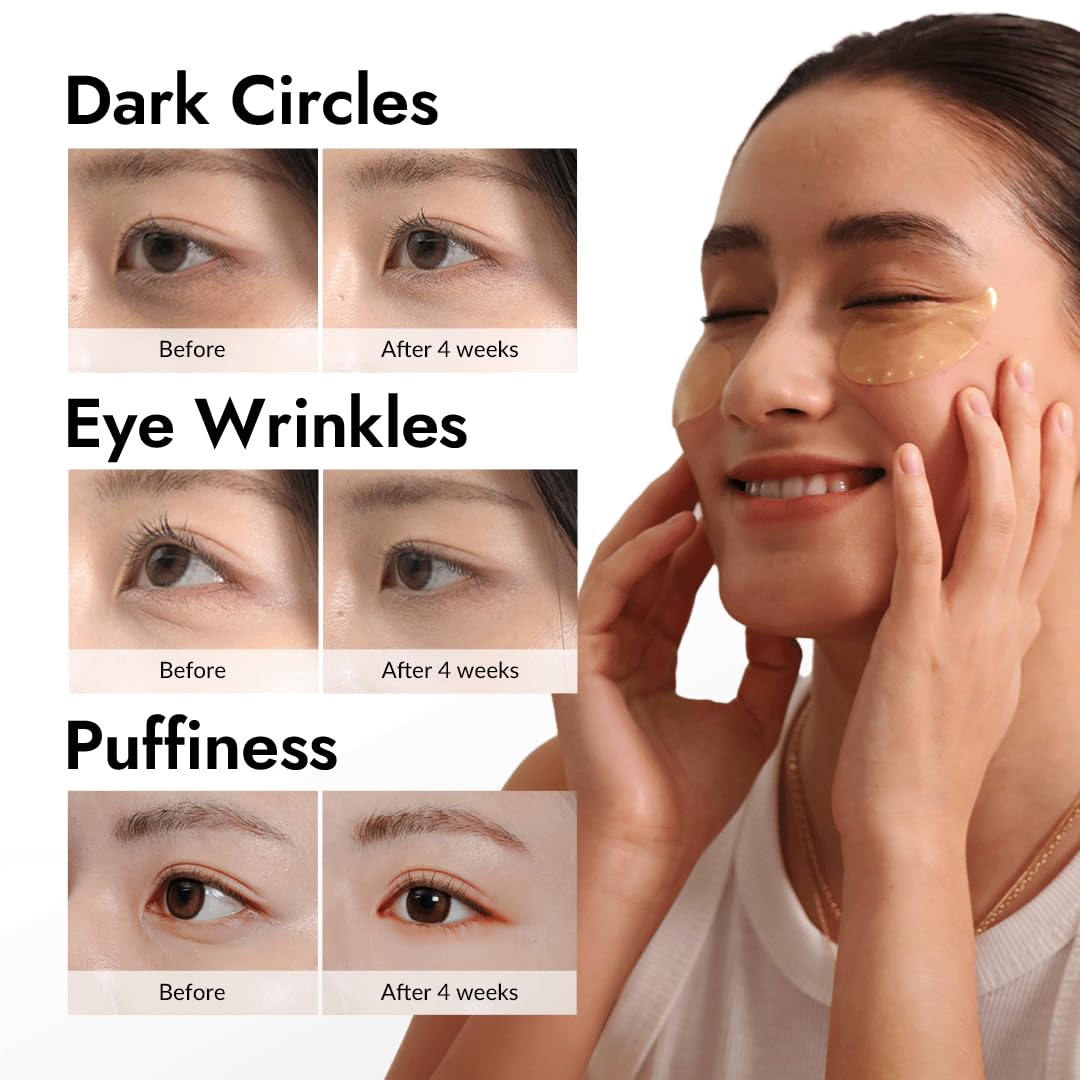 MIZON Under Eye Patches for Puffy Eyes & Dark Circles, 24K Gold & Snail Mucin, 60 Pcs