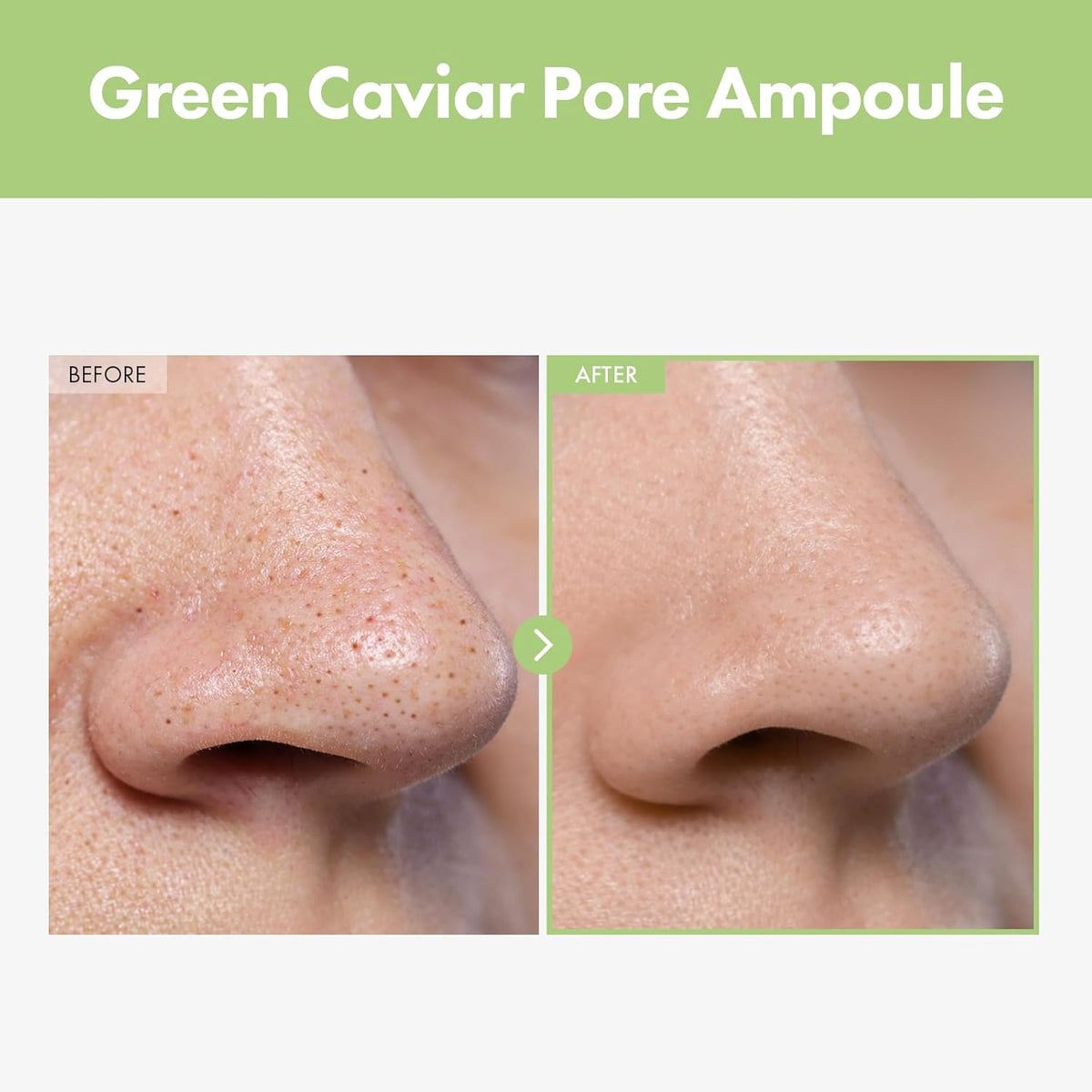 Green Caviar Pore Ampoule With 2,500ppm Green Caviar, Niacinamide, Pore Minimizer, Hydrating