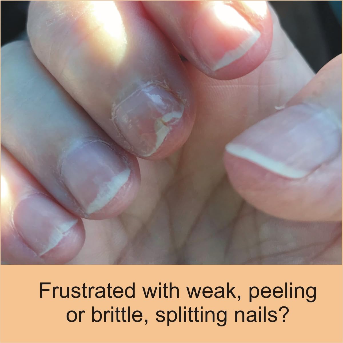 Penetrating Fingernail Conditioner and Strengthener to repair and then maintain weak and peeling or