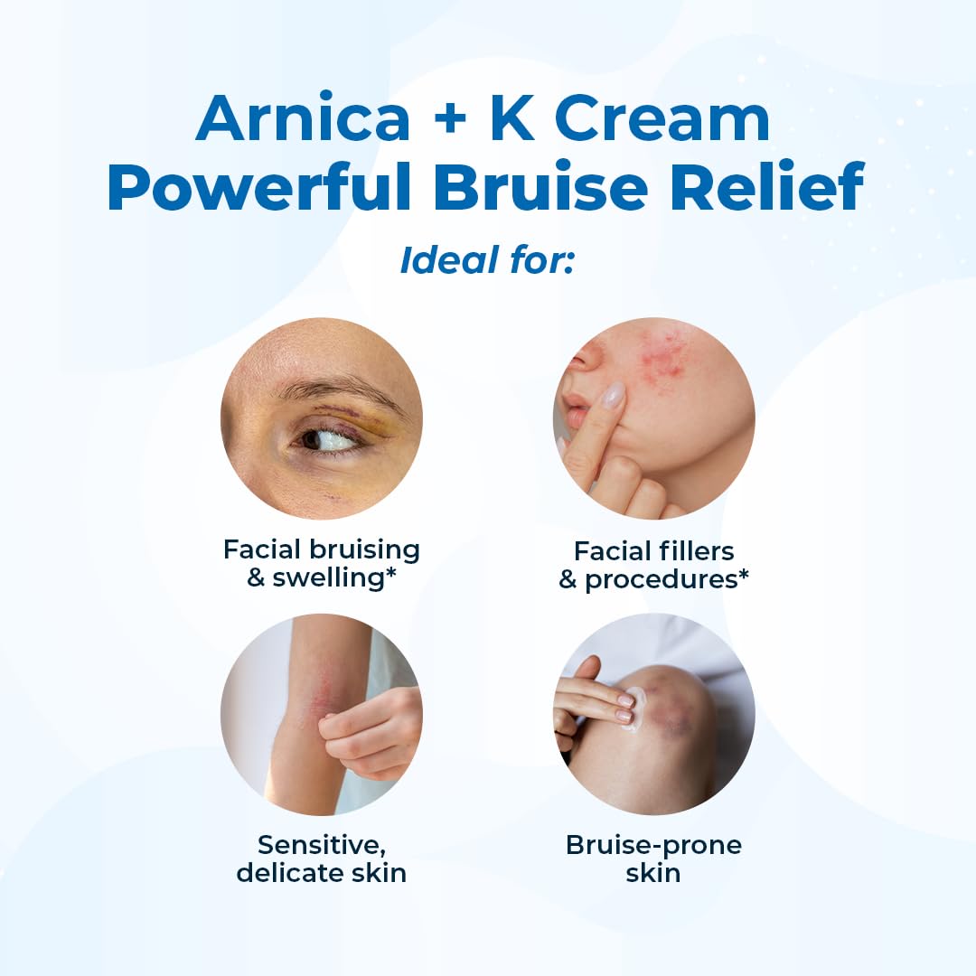 VitaMedica Arnica Cream - Arnica Montana + Vitamin K Oxide Bruise Cream - Sensitive Skin Formula
