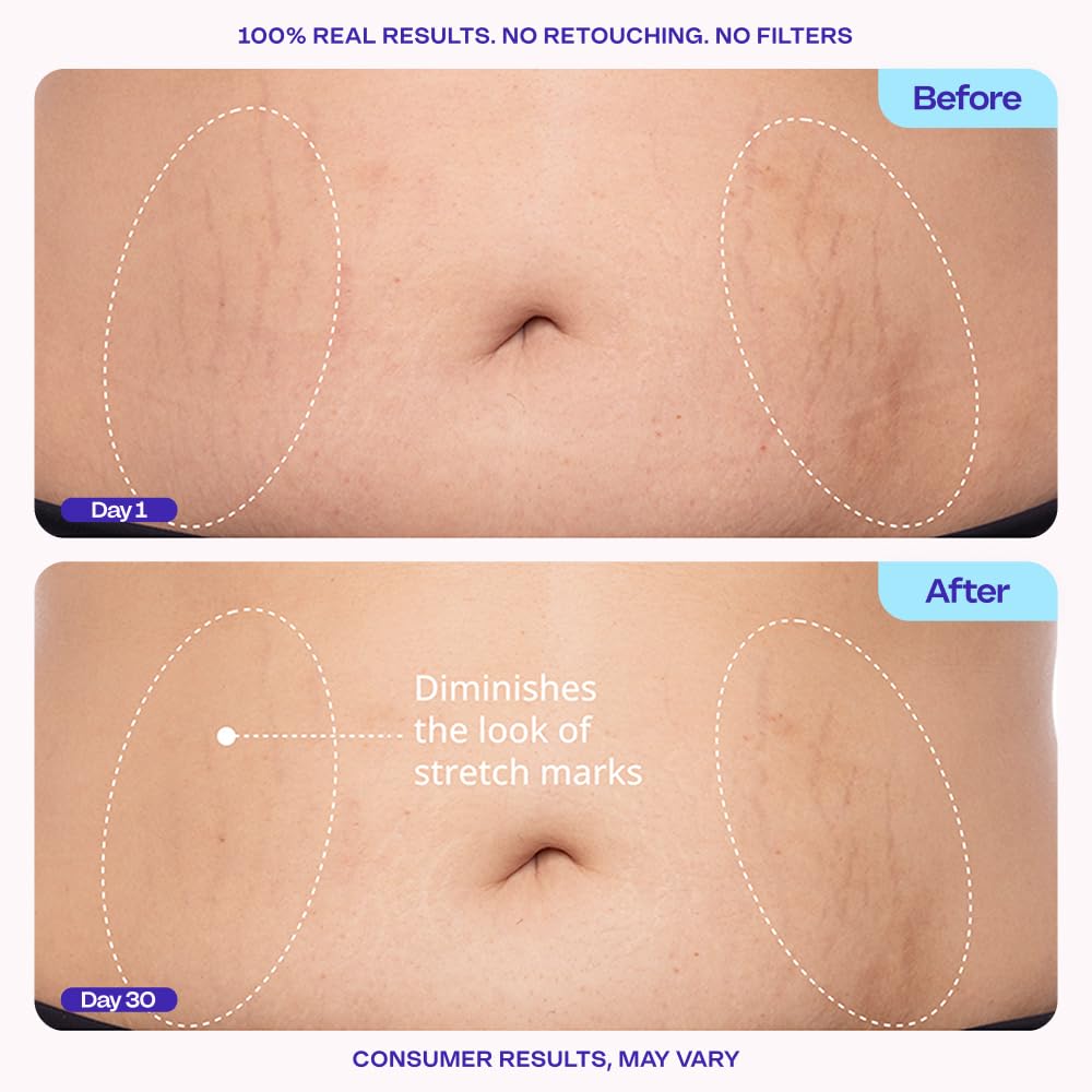 goPure Tighten & Smooth Belly Cream - Clinically Tested