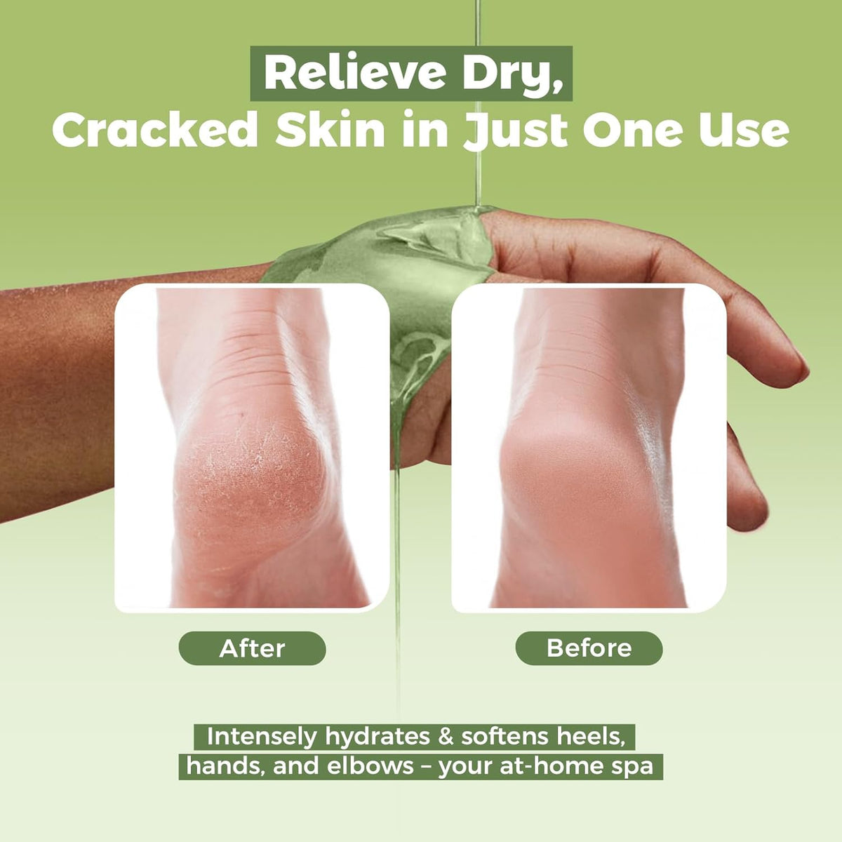 Paraffin Wax Refills 10 Packs for Paraffin Wax Bath Machine - for Dry Cracked Skin on Hands, Feet