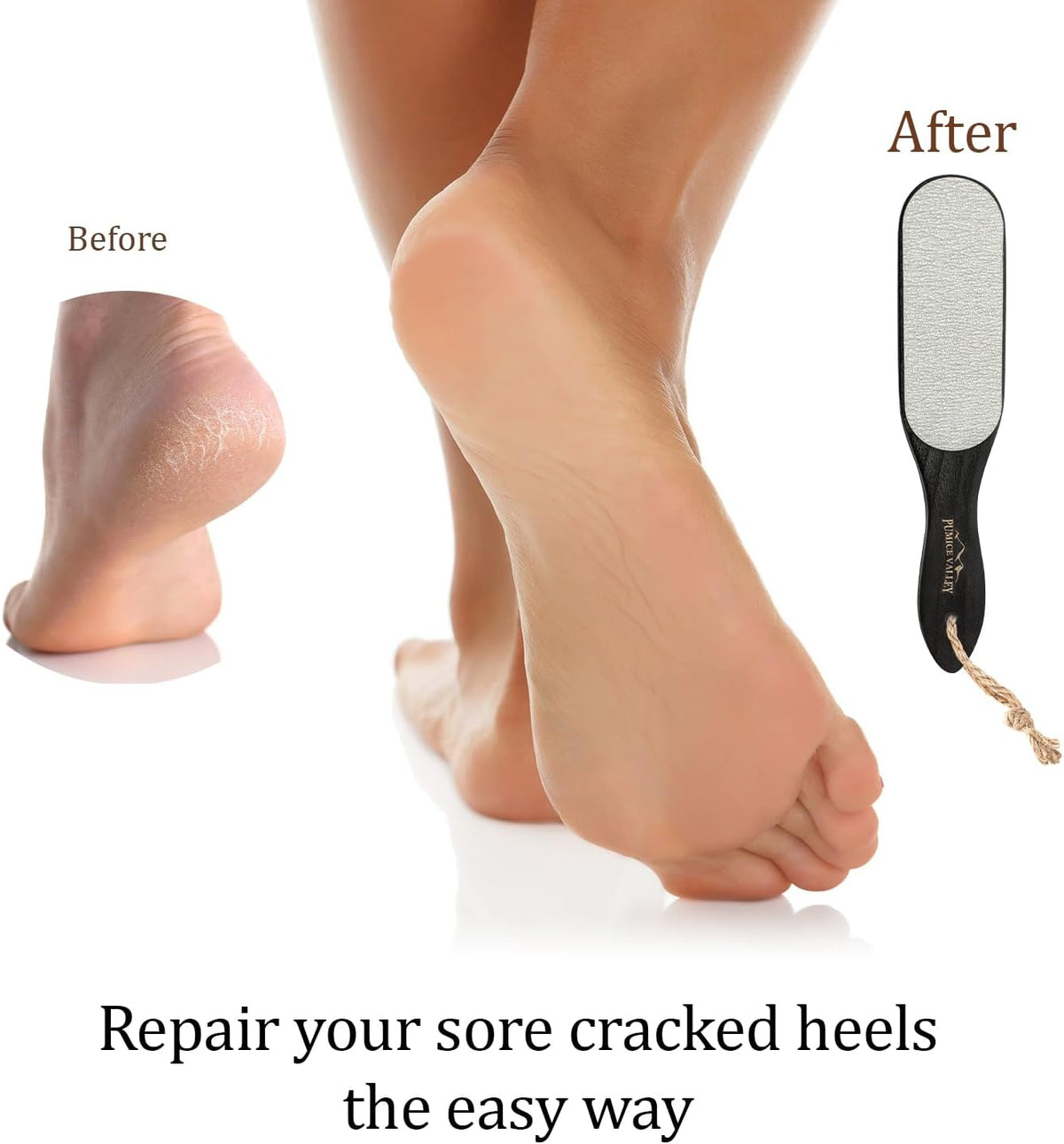 Pumice Stone Foot Scrubber - Pedicure Foot File with Handle for Dry Dead Skin - Callus Remover for