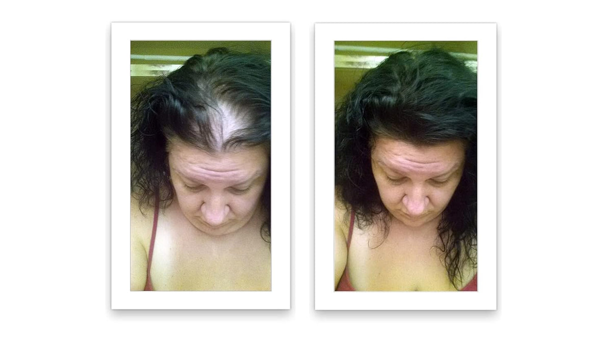Caboki Hair Loss Concealer, All-Natural Hair Building Fiber. Make Thin Hair Look 10X Fuller