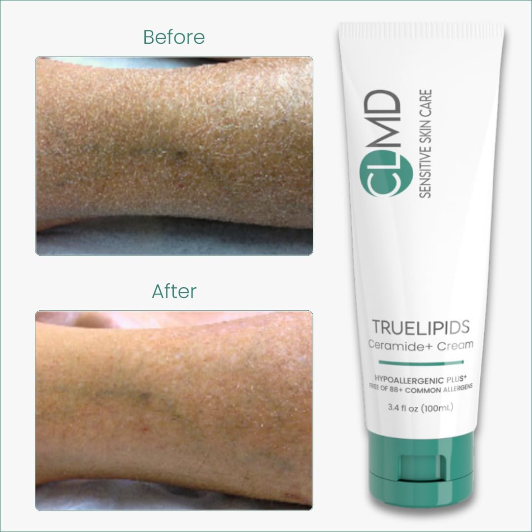 CLMD TrueLipids Ceramide+ Cream – Deep Moisturizing Barrier Support for Sensitive Skin – Hydrates