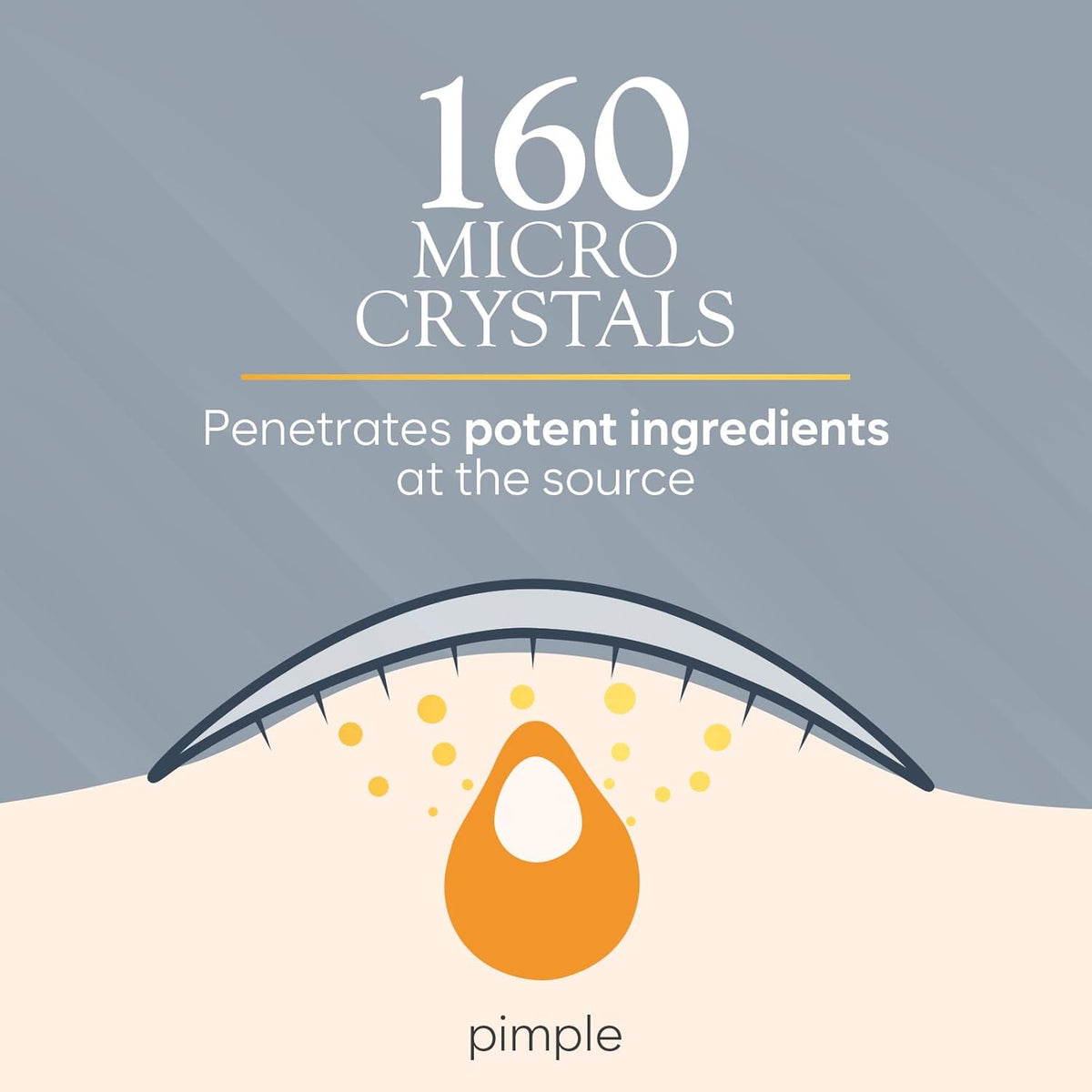 Microdart Acne Patch, Zit Patches for Cystic Acne Overnight Care, Cystic Acne Coverage, Pimple