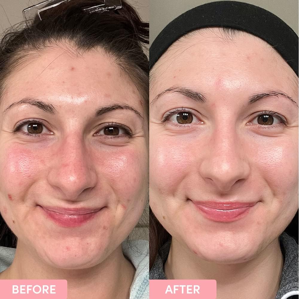 Sand & Sky Australian Essentials Brightening Toner with Niacinamide & Glycolic Acid - Marshmallow