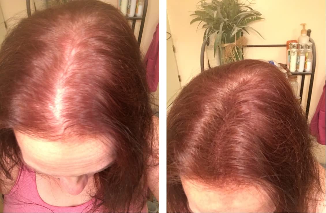 Caboki Hair Loss Concealer. All-Natural, Plant-Based Hair Building Fiber. Covers Bald Spot and