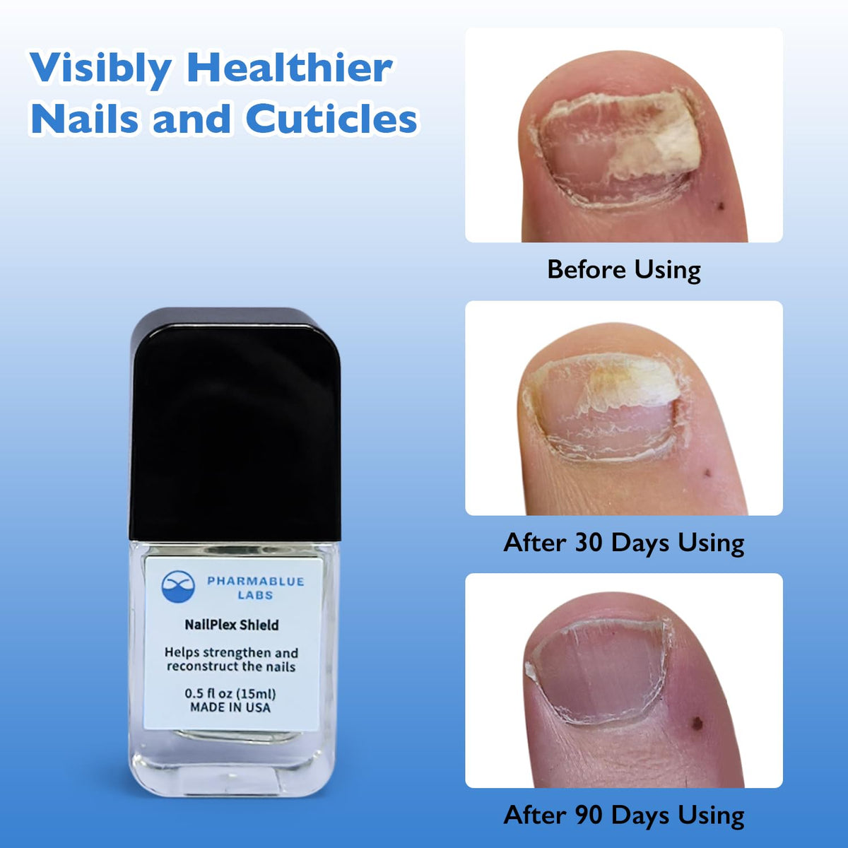 NailPlex Shield Nail Stregthener for Damaged Nails Nail Repair Advanced Formula Cuticle Serum