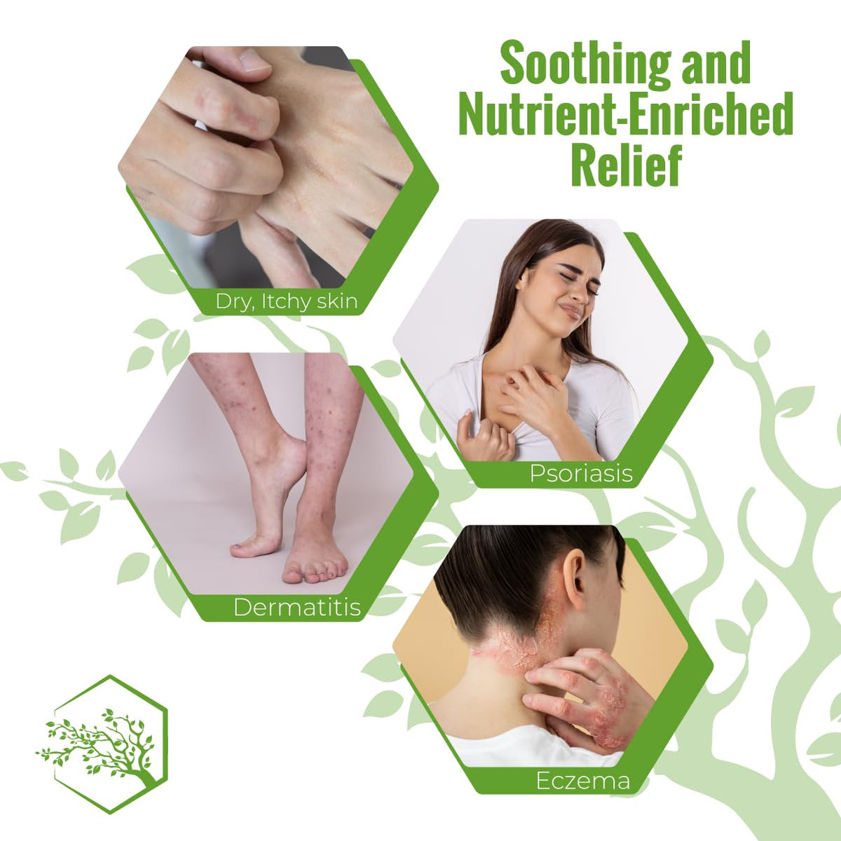 Moisturizing Eczema Body Wash – Gentle Psoriasis Body Wash for Itchy, Dry Skin Relief – Eczema Soap