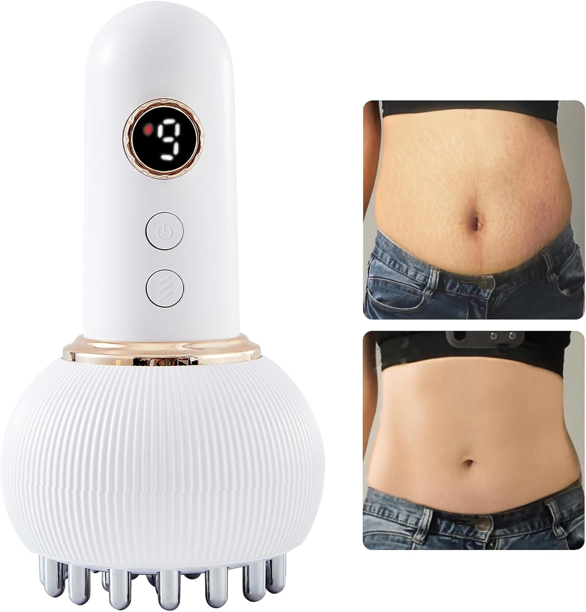 Lymphatic Drainage Massager & Anti Cellulite Massage Tool, Helps Reduce Stretch Marks & Cellulite