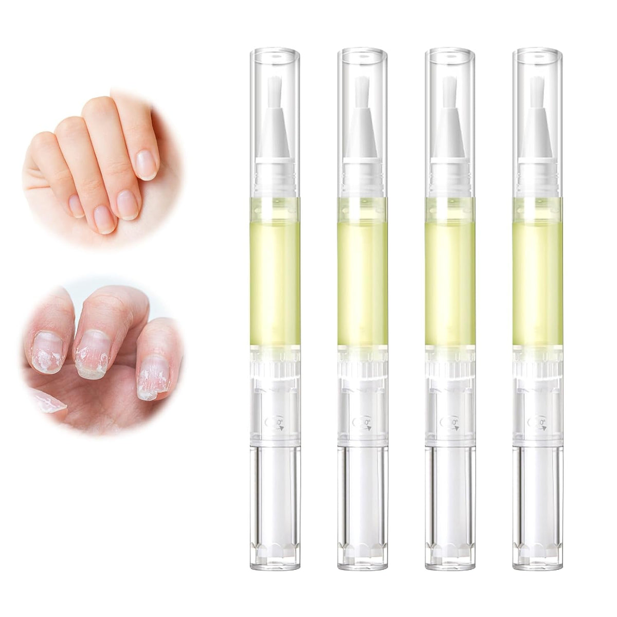 Nailz Nail 𝐆𝐫𝐨𝐰𝐭𝐡 Pen,Radiant Nail Growth GIL,Radiant Nail Growth Oil Pen,Cuticle Oil for