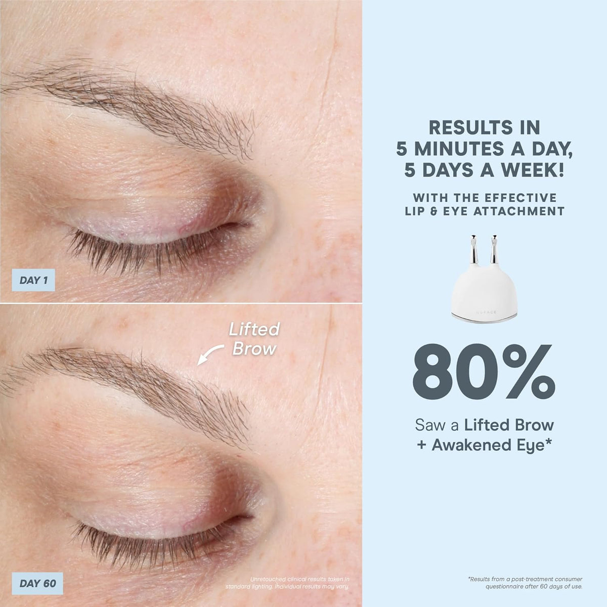 NuFACE TRINITY+ Microcurrent Facial Device + Effective Lip & Eye Attachment - FDA Cleared Skin