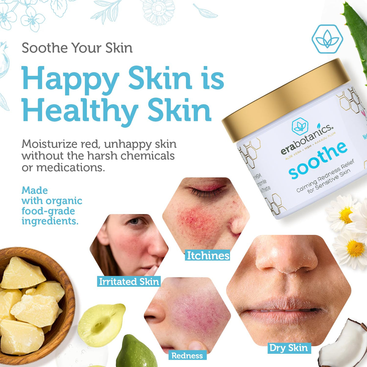 Era Organics Cream Redness Relief Moisturizer- Soothing Redness Relief for Face with Manuka Honey