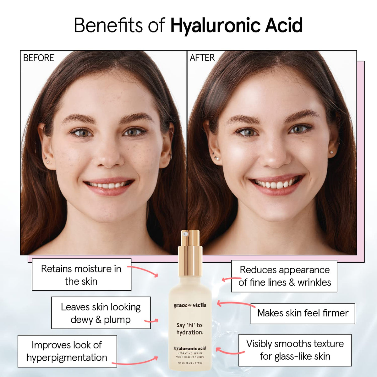 grace & stella Award Winning Hyaluronic Acid Serum (50ml/1.7 fl oz) Hydrating Hyaluronic Acid Serum