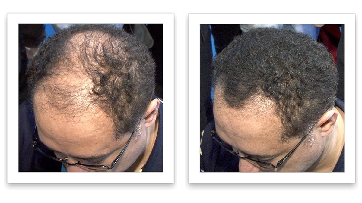 Caboki Hair Loss Concealer, All-Natural Hair Building Fiber. Make Thin Hair Look 10X Fuller