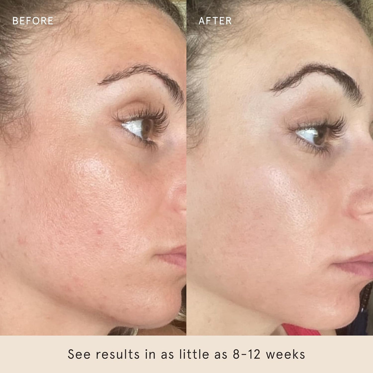 Barefaced Toning Pads (60 count) - Exfoliating Face Pads with 2% Glycolic Acid & Salicylic Acid