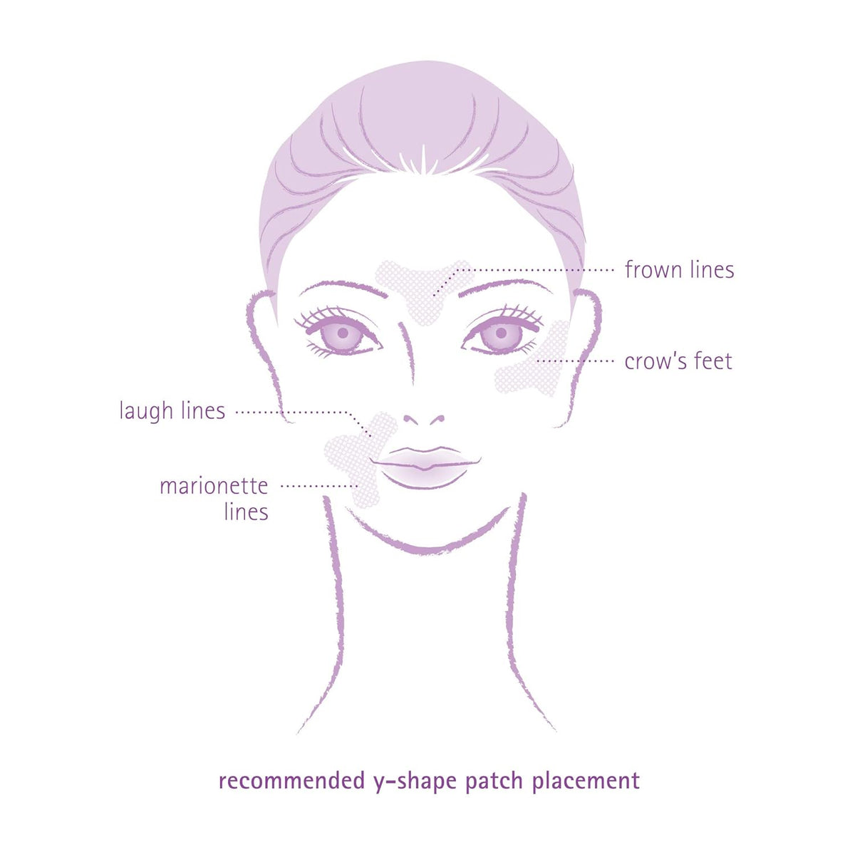 Toute Nuit Wrinkle Patches – Y Shape – Face Tape for Forehead, Between the Eyes & Around Mouth