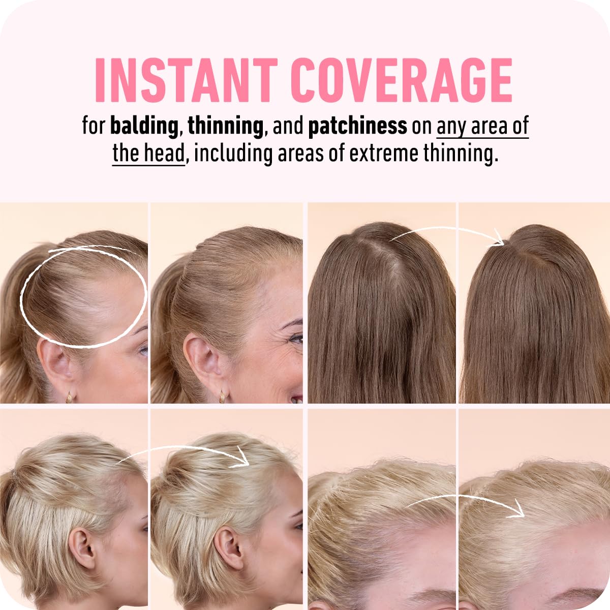 BOLDIFY Hairline Powder (LARGE, 10g) - Root Touch Up Hair Color for Gray Coverage - Bald Spot