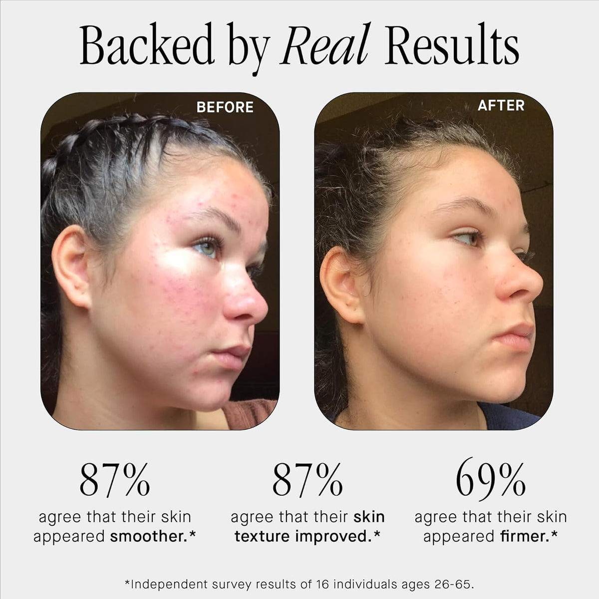 Brandefy No Needles - Niacinamide Serum, Peptides and Hyaluronic Acid. Hydrating & Plumping Serum