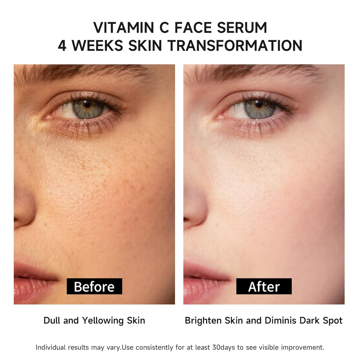 Vitamin C Face Serum with Glutathione, 4D Hyaluronic Acid & Aloe Vera – Lightweight Brightening &