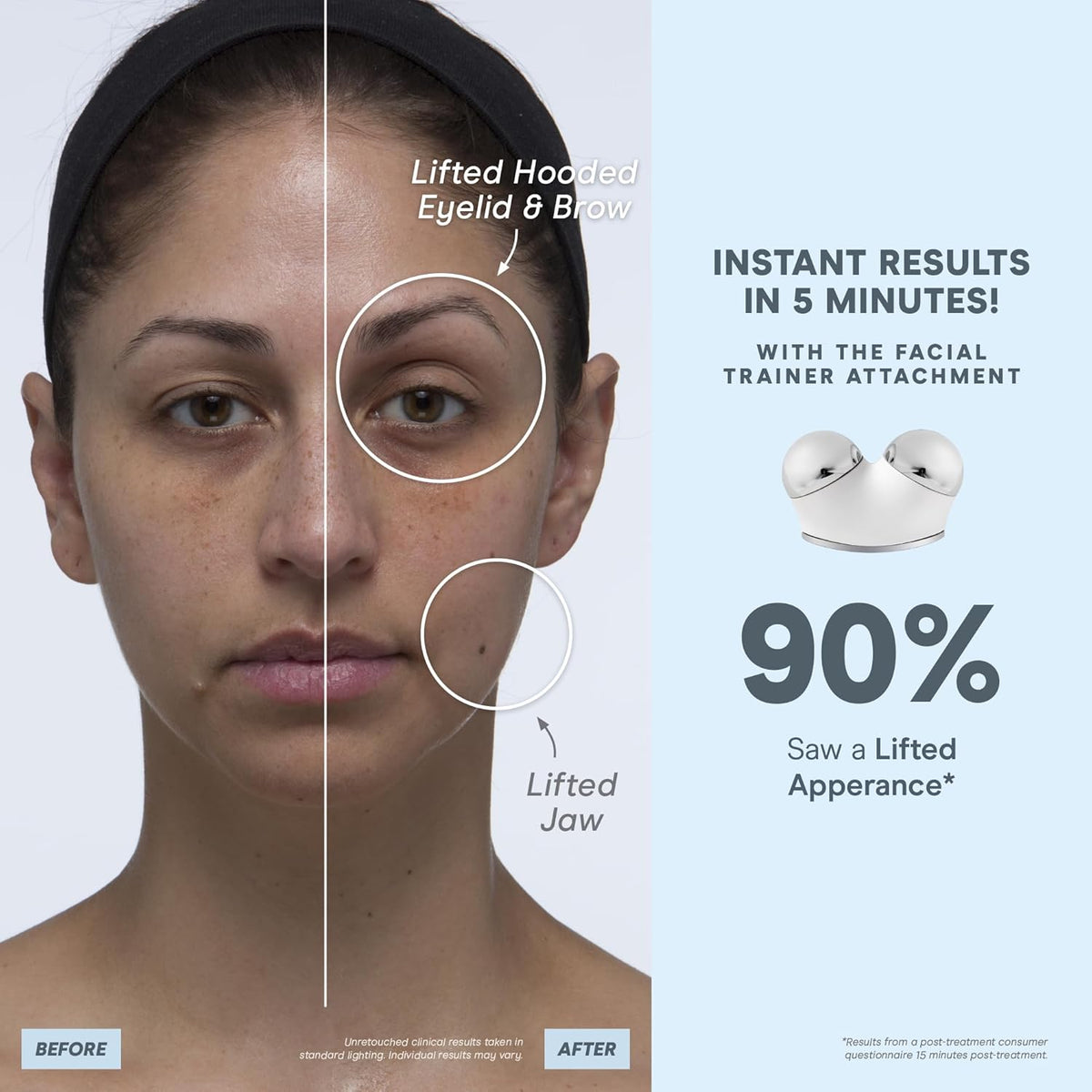NuFACE TRINITY+ Microcurrent Facial Device Kit - FDA Cleared Face Sculpting & Neck Tightening