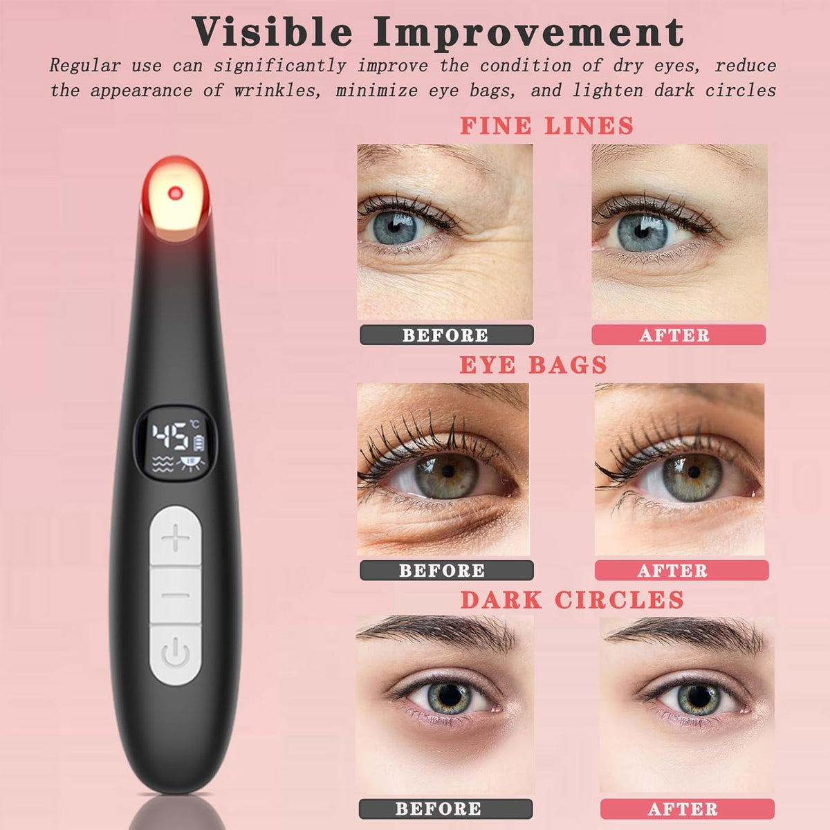 Eye Lift Wand, 3 in 1 Vibrating 98°F to 113°F LCD Eye Massager for Dry Eyes, Dark Circles and