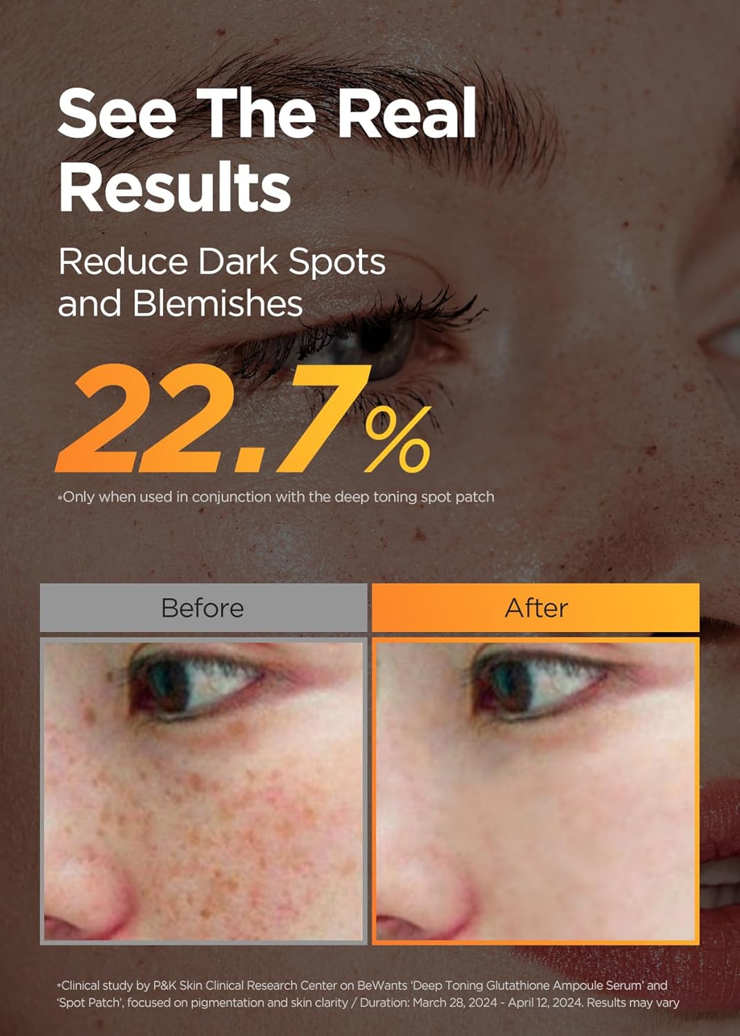 Bewants Skin Brightening Glutathione Serum, Deep Toning Complex for Even Skin Tone, with Vitamin C