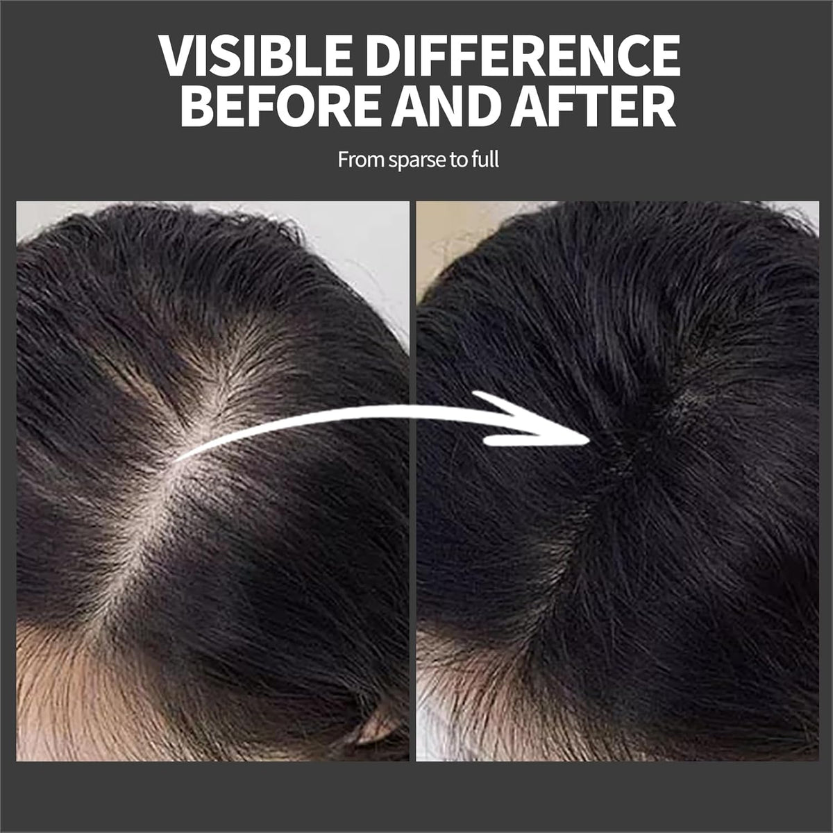 Hair Building Fibers - Instant Volume for Thinning Hair, Natural Appearance with Electrostatic