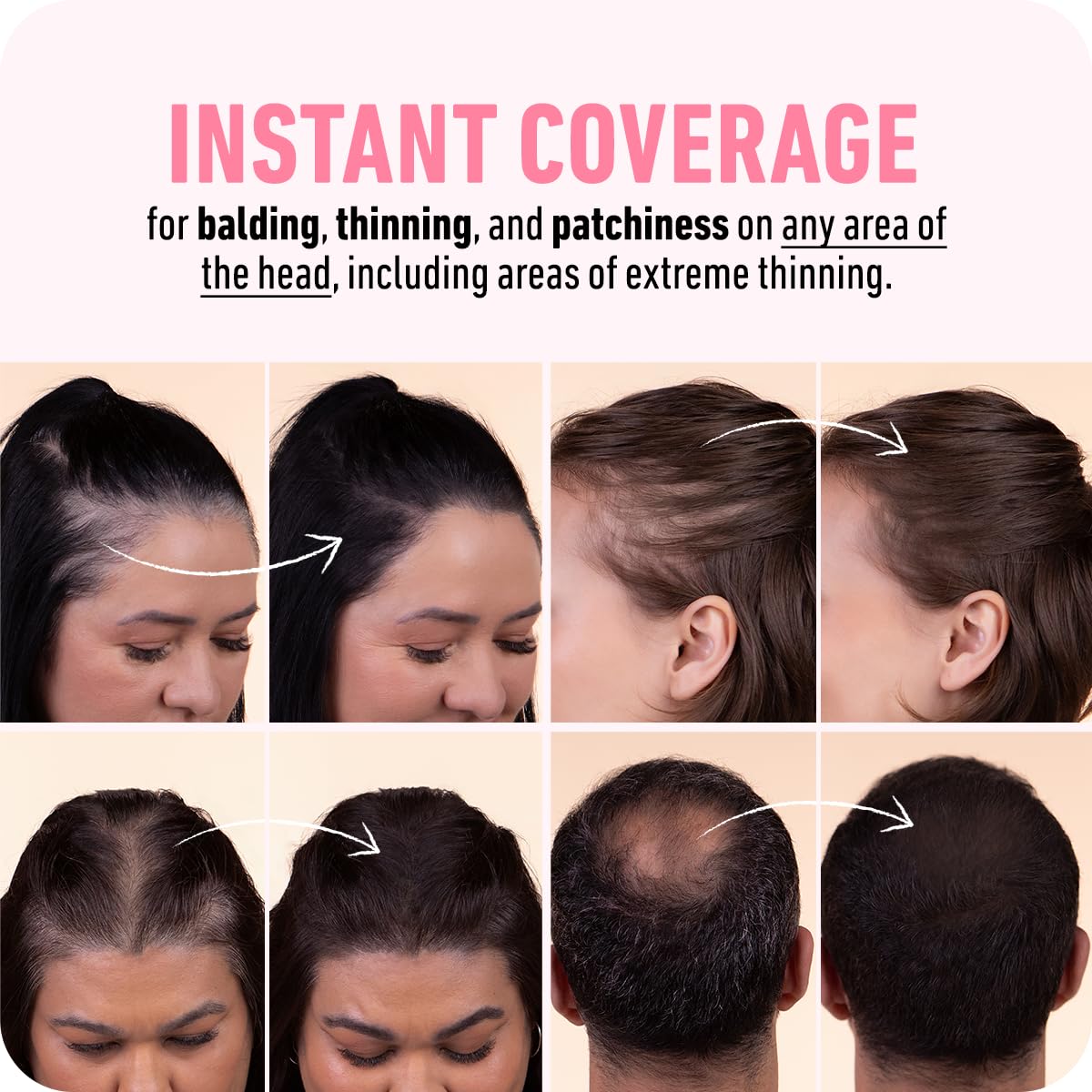 BOLDIFY Hairline Powder (LARGE, 10g) - Root Touch Up Hair Color for Gray Coverage - Bald Spot