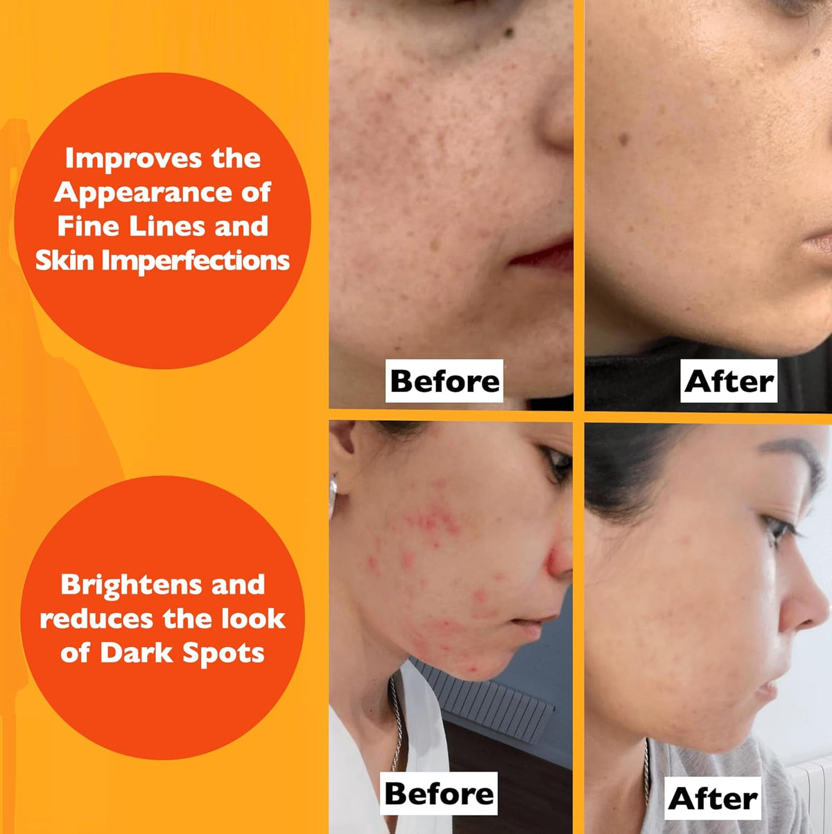 Vitamin C Serum For Face – Anti-Aging Facial Serum with Vitamin C, Hyaluronic Acid, Niacinamide, B5