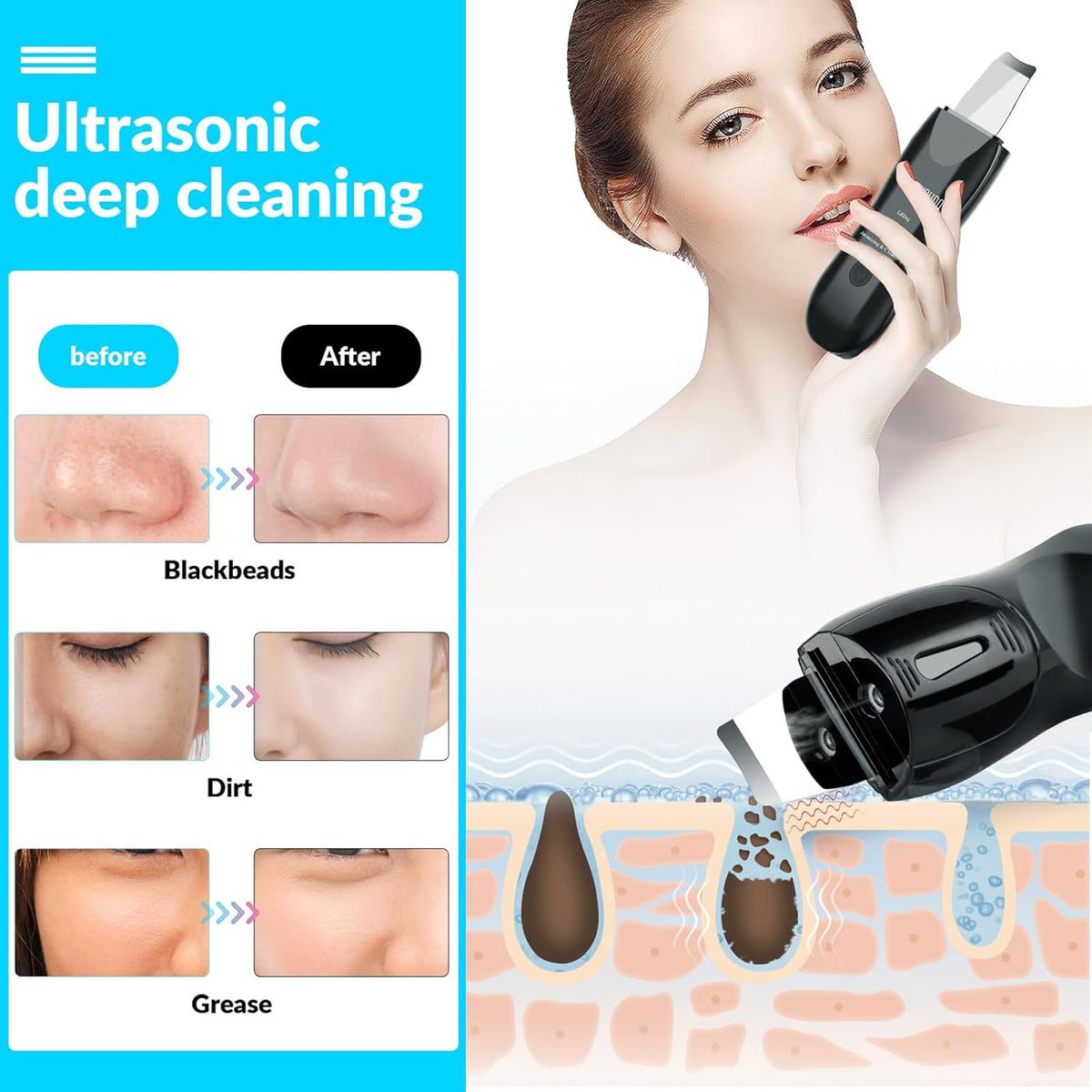 Facial Skin Cleanser with Mister, Upgraded Sprayer, Blackhead Extractor for Deep Cleansing and