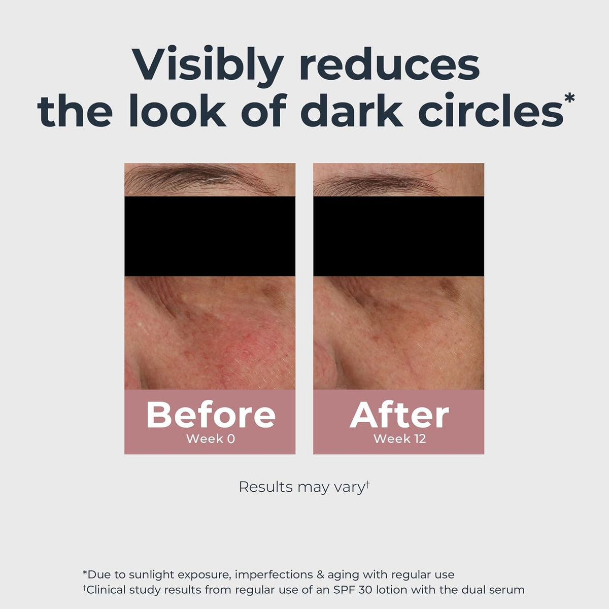 Eucerin Radiant Tone Eye Cream Dark Circle Corrector, Eye Brightening Cream with Thiamidol and