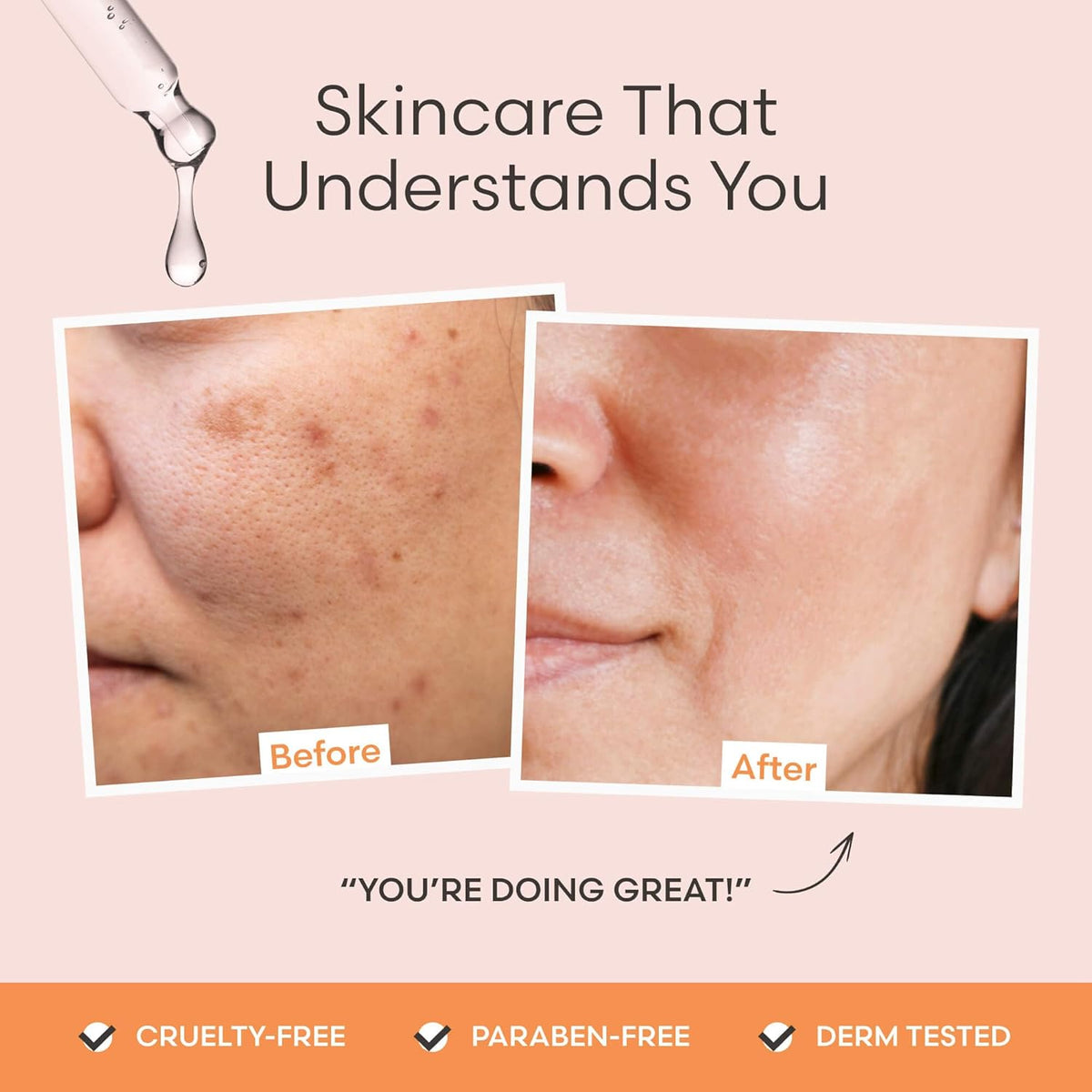 Vitamin C Serum for Face by Outofshell Beauty – 4-in-1 with Real Retinol, Hyaluronic Acid