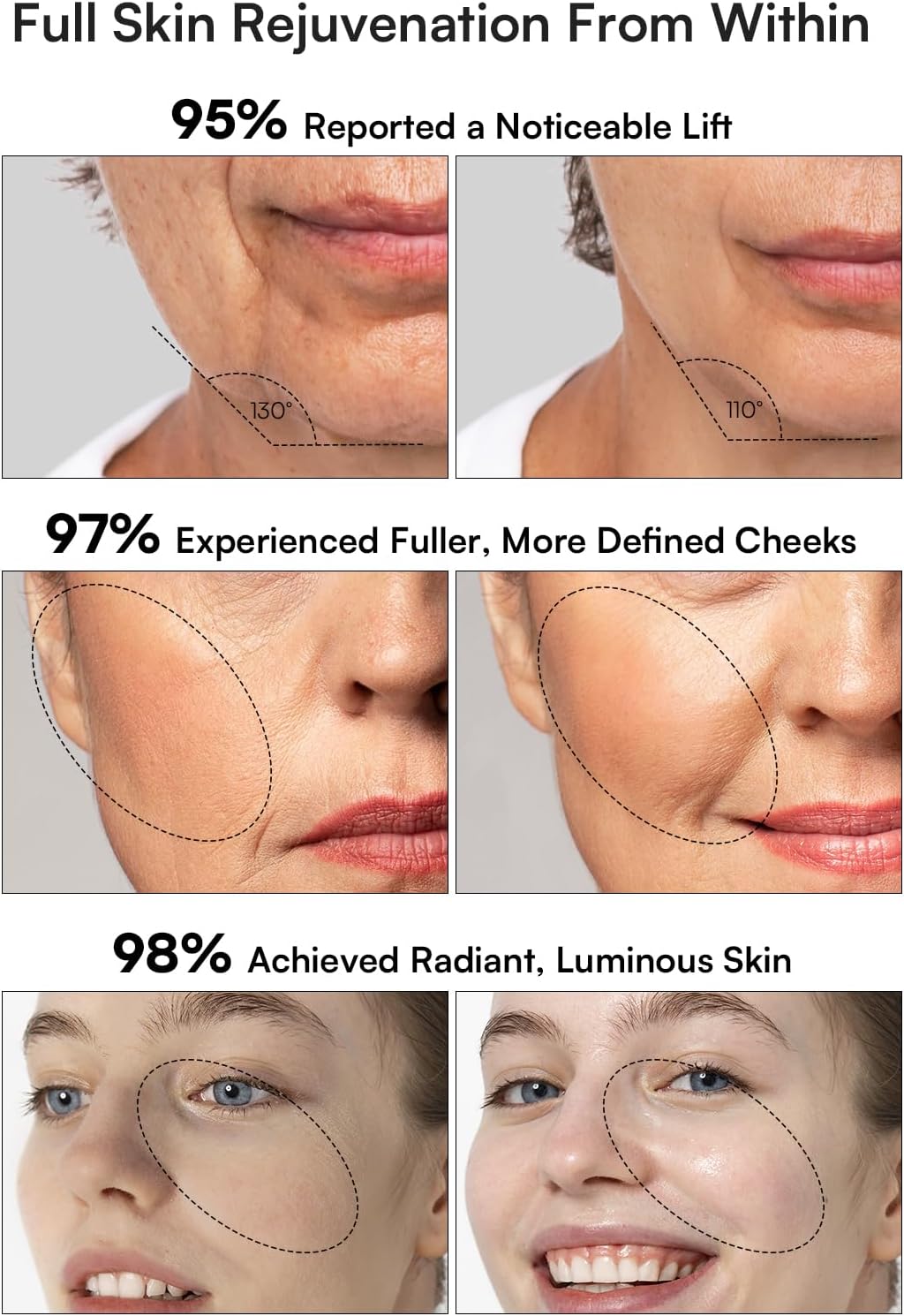 INIA 3-in-1 Red Light Therapy for Face and Neck Beauty Device for Puffiness & Skin Firming Skincare