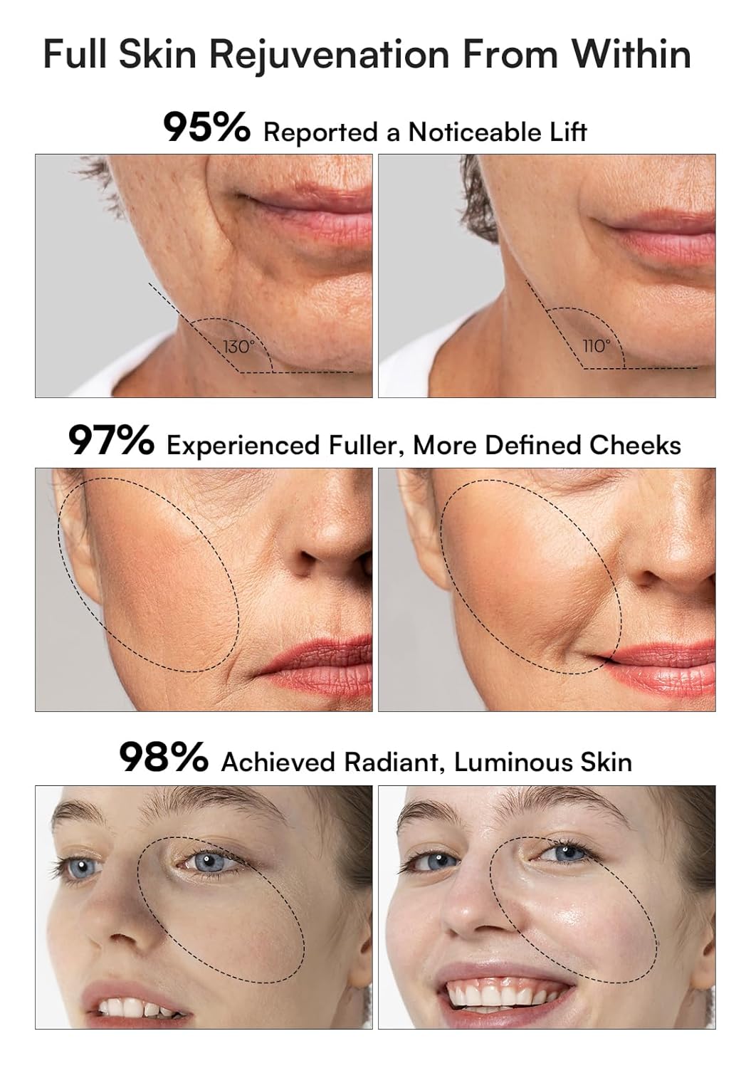 INIA 3-in-1 Red Light Therapy for Face and Neck, Skin Tightening Device True Beauty Glow Facial