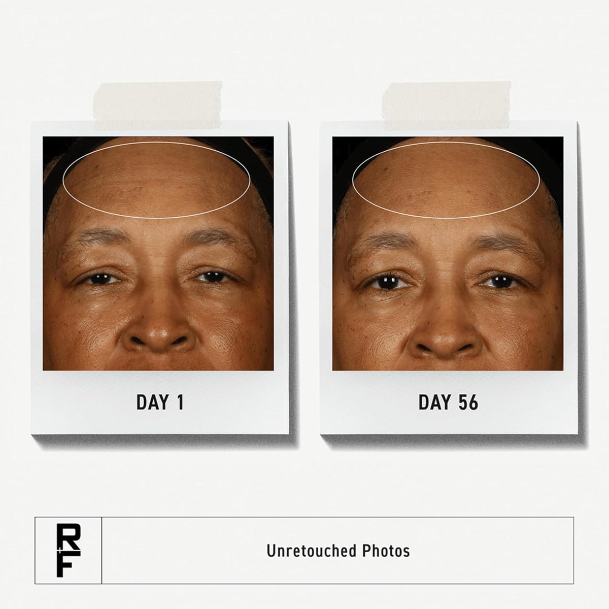 Rodan + Fields Redefine Pore Minimizing Toner | 4.2 fl oz | Deep Exfoliating Cleanser | Visibly