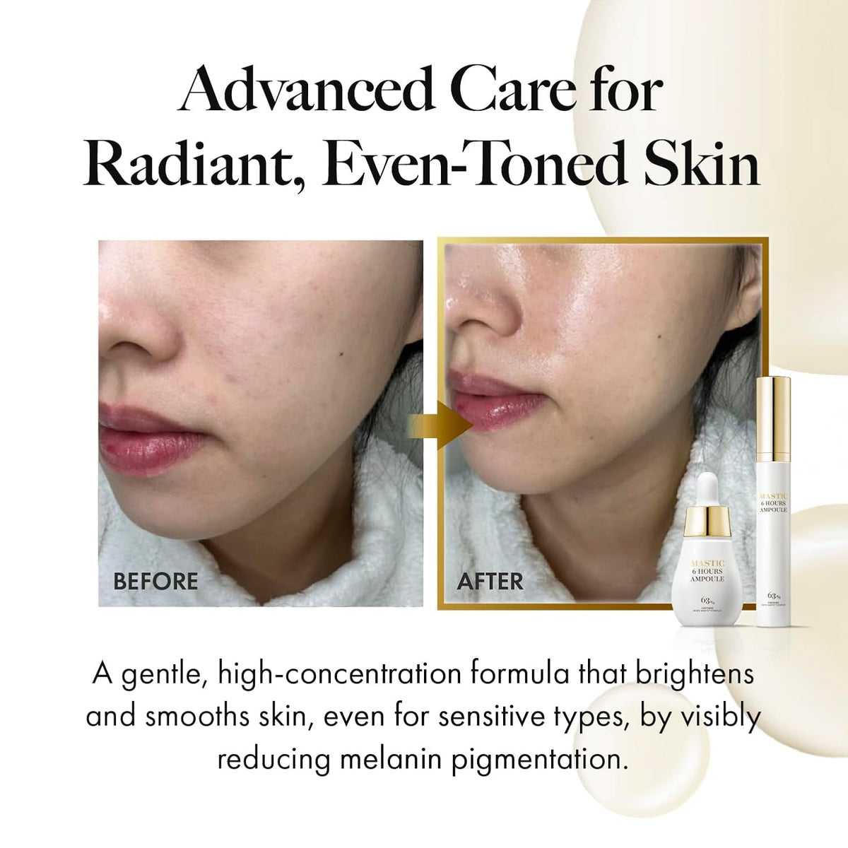 MASTINA Mastic Serum Roller - Dark Circle Remover & Eye Serum for Brighter, Firmer Under Eyes