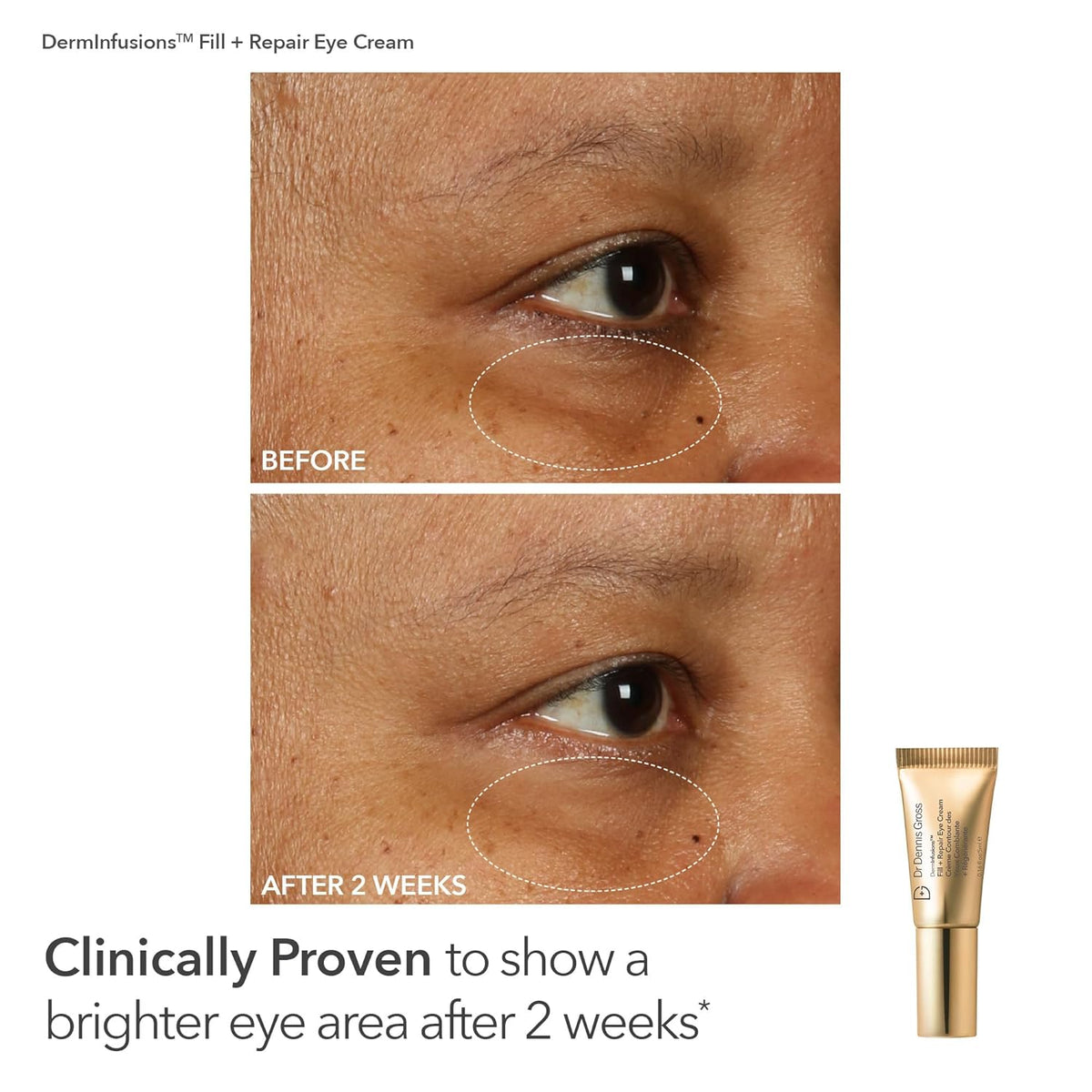 Dr. Dennis Gross Fill, Plump & Firm Kit – DermInfusions™ Hyaluronic Acid Serum, Eye Cream & Lip