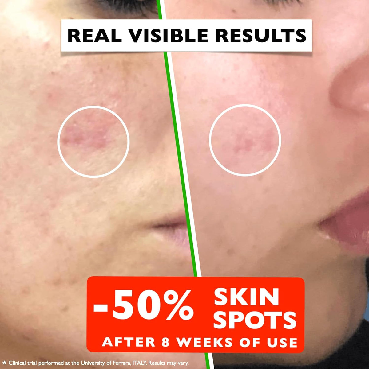 Vitamin C Serum For Face – Anti-Aging Facial Serum with Vitamin C, Hyaluronic Acid, Niacinamide, B5