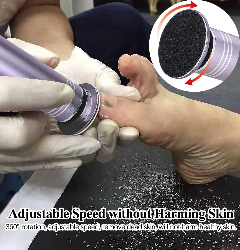 Upgraded Electric Callus Remover for Feet 1200rpm, Adjustable Speed Professional Electric Foot
