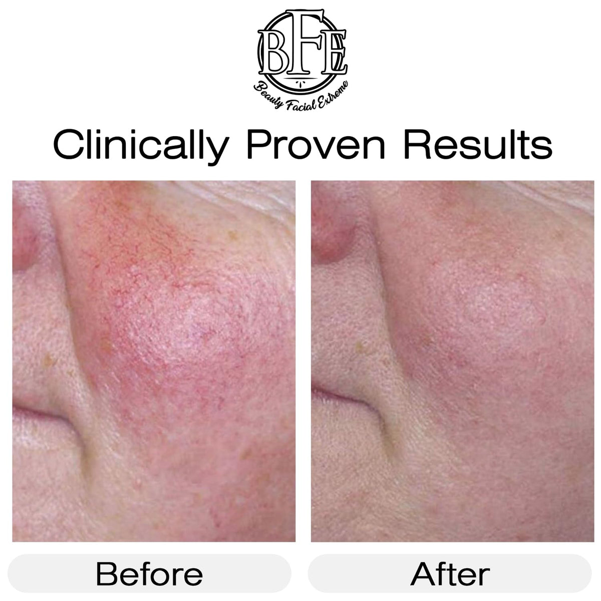 Vitamin K Cream- Moisturizing Bruise Healing Formula. Dark Spot Corrector for Bruising, Spider