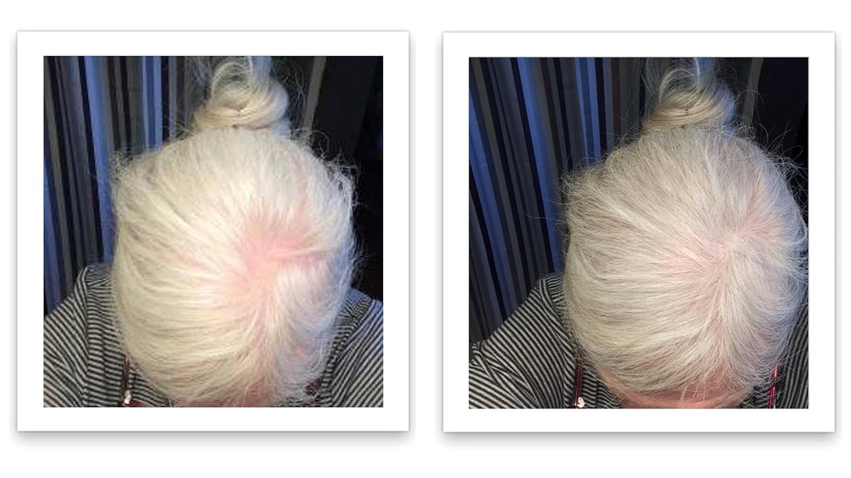 Caboki Hair Loss Concealer. All-Natural Hair Building Fiber. Make Thin Hair Look 10X Fuller