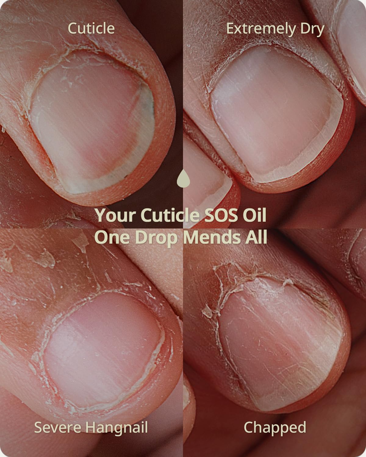 BTARTBOXNAILS Nutri-Forte Cuticle Oil - Pure Oil Formula with Olive Oil, Vitamin E, Squalane, Deep