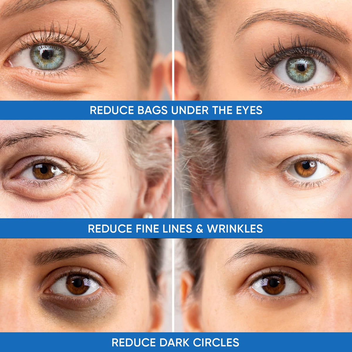 Under Eye Puffiness & Dark Circles Rapid Treatment- Instantly Reduces the Appearance of Puffy Eye