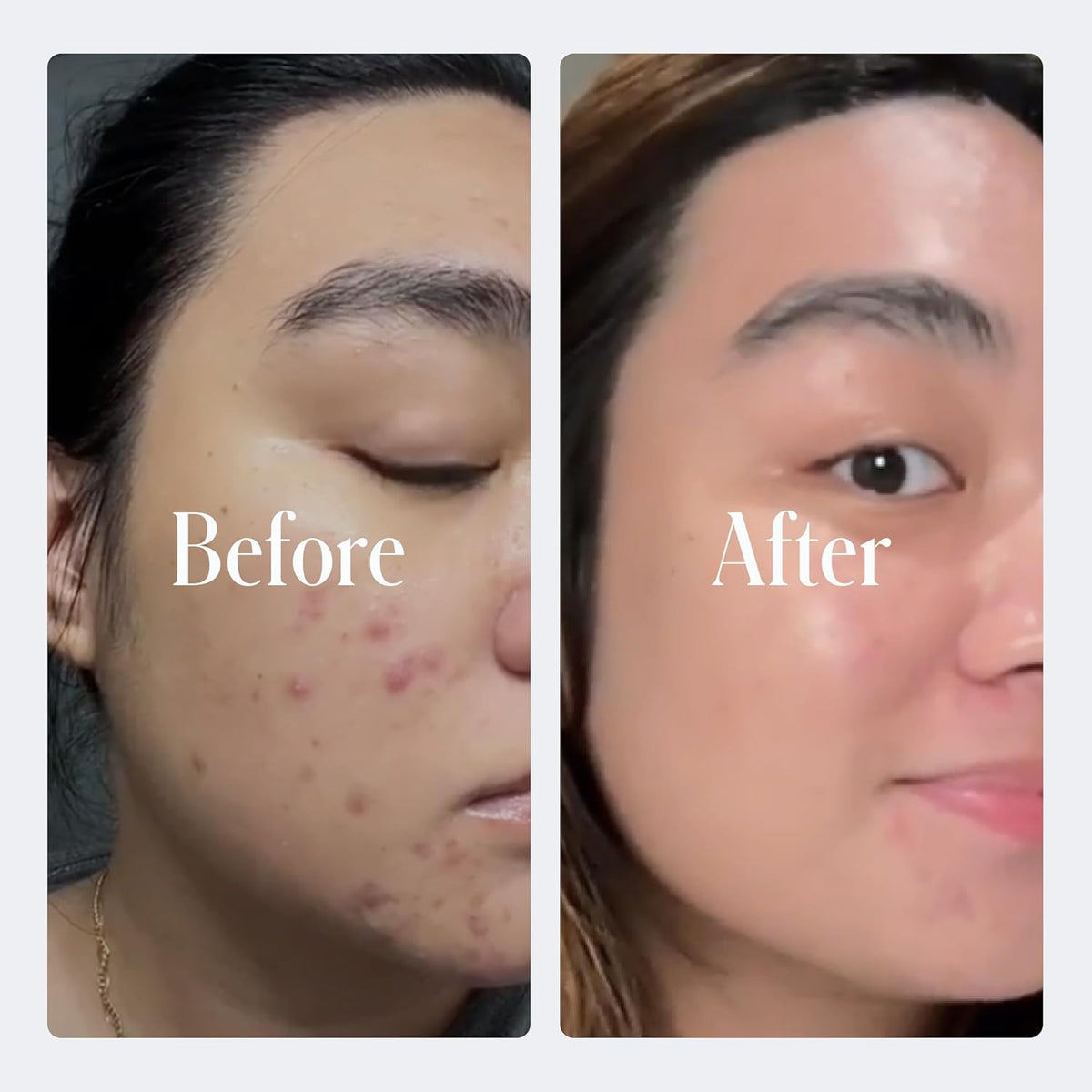 Geologie Retinol Anti-Aging Face Cream | Advanced .3% Retinol Formula for Effective Results |