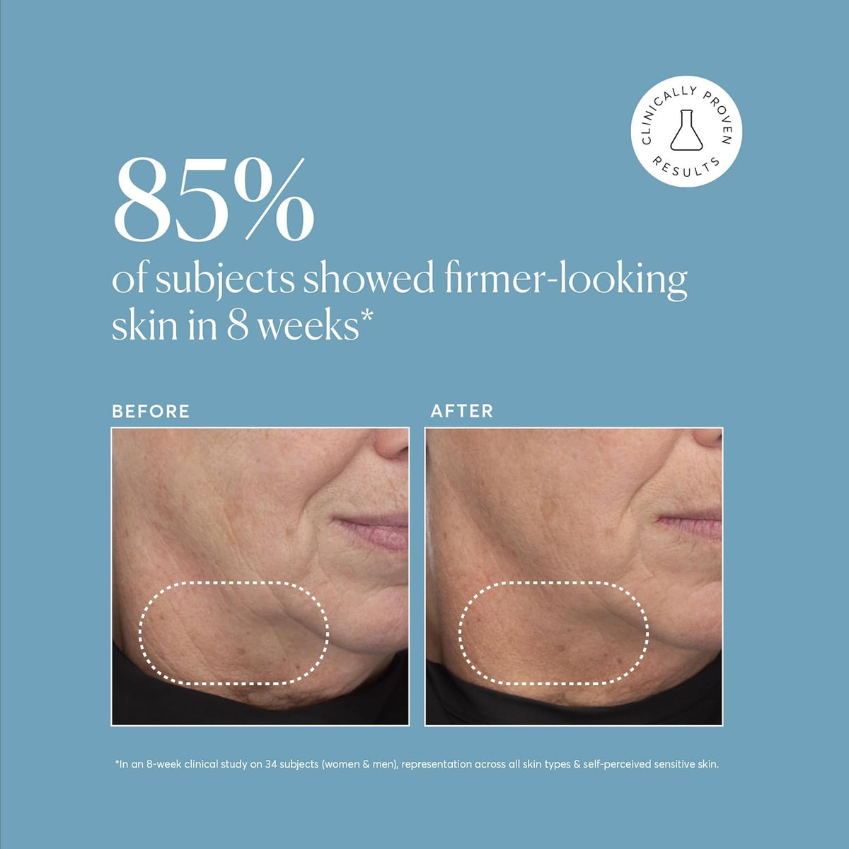 Naturium Retinol Complex Serum, Encapsulated Retinols & Bakuchiol, Refining & Smoothing Facial