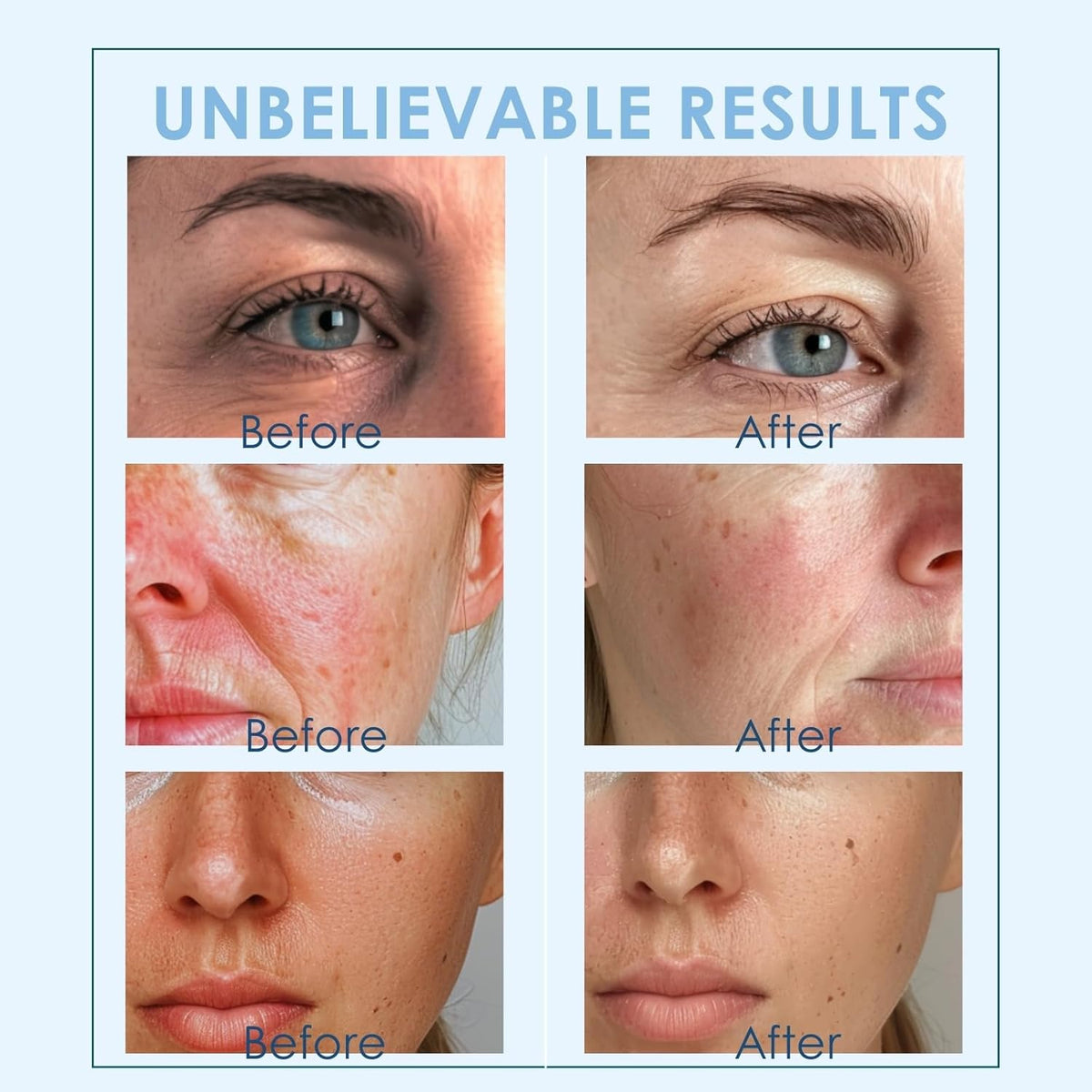 Facial Ice Globes Cryo Sticks, Cooling Beauty Tool for Face, Neck & Eyes, Helps Reduce Puffiness